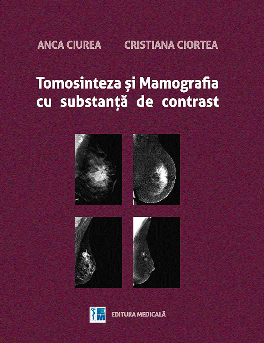 Tomosinteza și Mamografia cu substanță de contrast