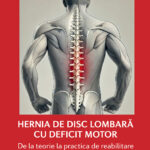 Hernia de disc lombară cu deficit motor. De la teorie la practica de reabilitare